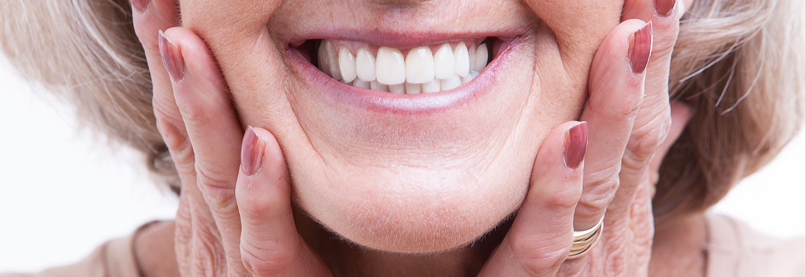 Elderly woman with dentures